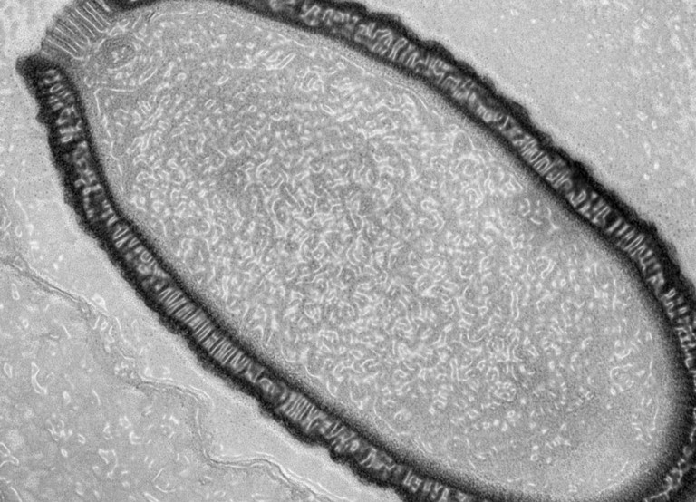 Pithovirus Sibericum, en chair et en cellules. Pas délit de sale gueule, il est inoffensif. En revanche, rien ne nous dit que ses copains encore emprisonnés sous la glace le seront également.